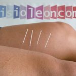 Tratamiento Punción Seca